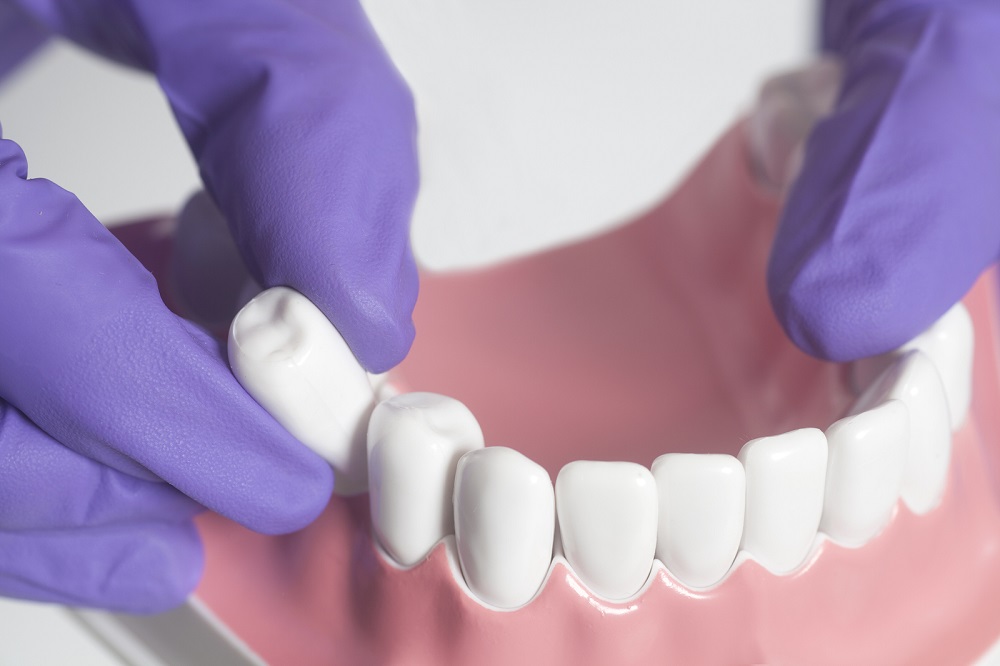 Dental Exam: What Can You Expect?