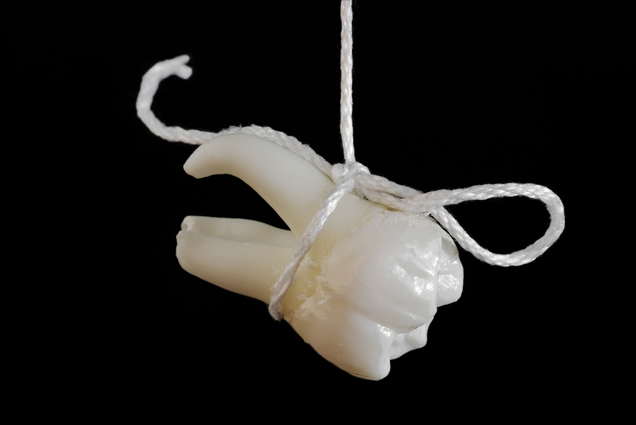 Common Reasons for Tooth Extraction: When is it Necessary?