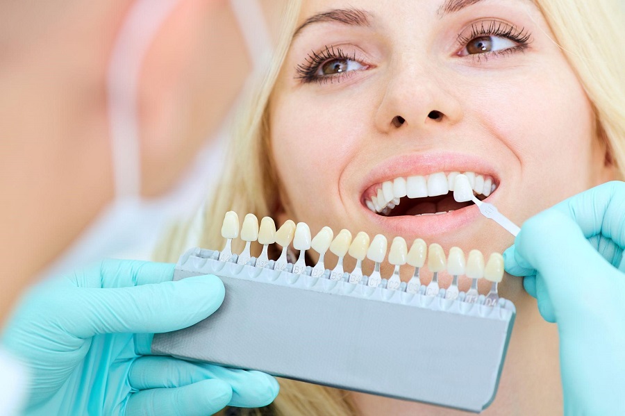 Aftercare Tips for Professional Teeth Whitening