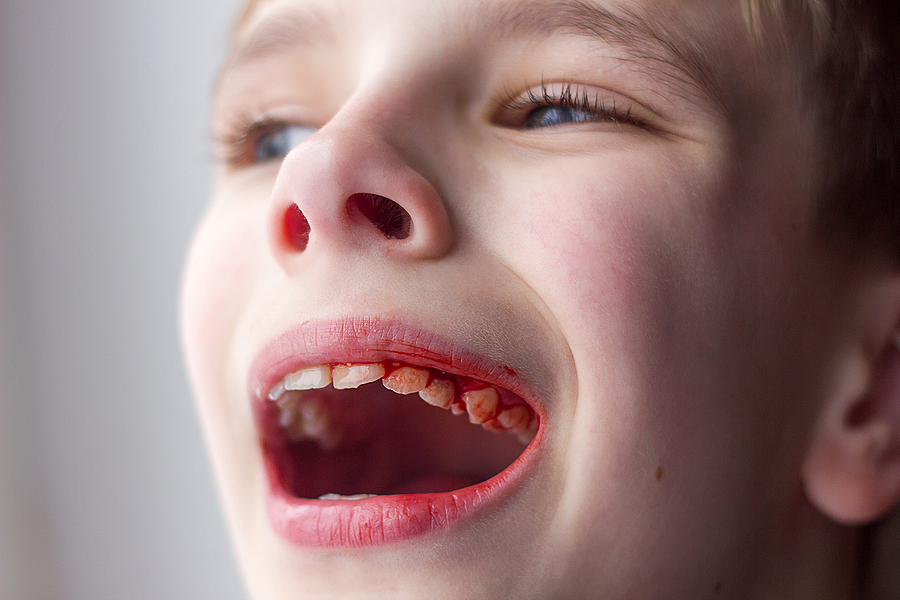4 Habits that are Damaging Your Oral Health