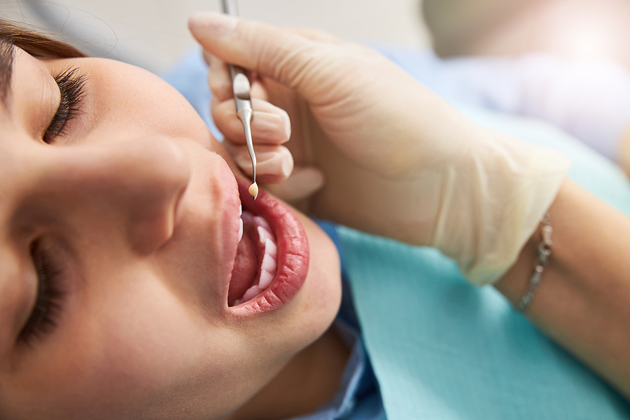 How to Prevent Dry Socket After an Extraction
